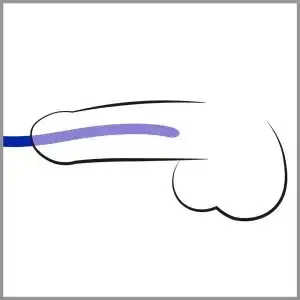 You2Toys Silikon Dilator Set - 3 Harnröhren-Dehner, verschiedene Durchmesser Dunkelblau You2Toys Silikon Dilator Set - 3 Harnröhren-Dehner, verschiedene Durchmesser Dunkelblau – Bild 3