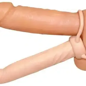 Anal Special nature Anal Special nature – B