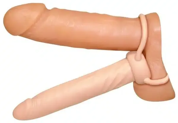 Anal Special nature – B