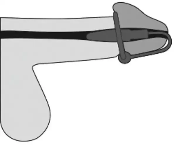 Silikon-Eichelring Dilator - Urethrale Freuden Lila, Silber Silikon-Eichelring Dilator - Urethrale Freuden Lila, Silber