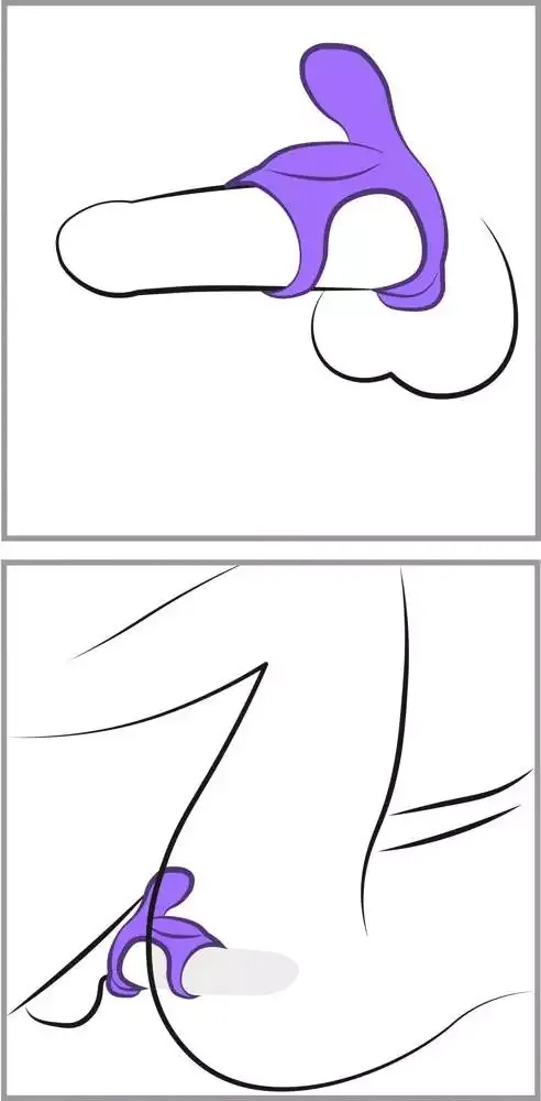 Fantasy C-Ringz - Ultimate Couples Cage. Fantasy C-Ringz - Ultimate Couples Cage.